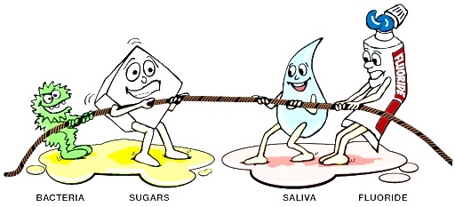 tooth decay process described in this bacteria, sugar, saliva, fluoride, tug of war cartoon image